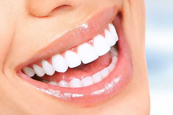 Smiling woman with bright white teeth, showcasing a dental product.