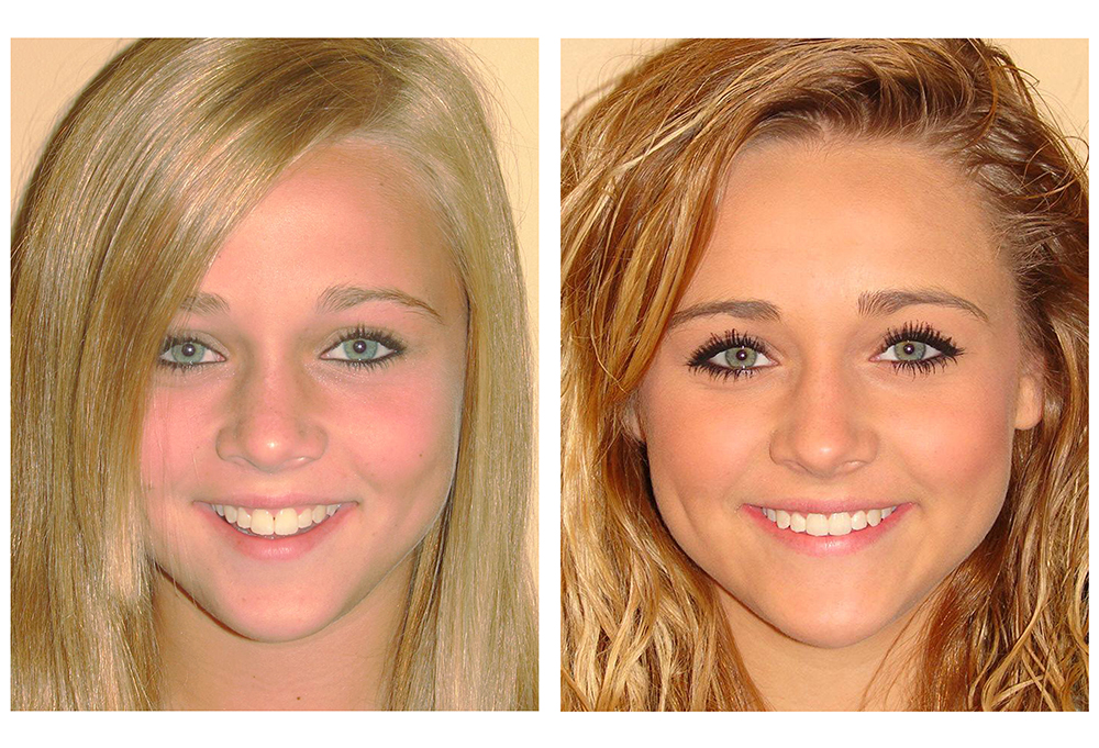 Nik Family   Cosmetic Dentistry