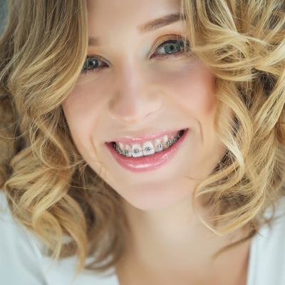 A smiling woman with braces, wearing a white top and curly blonde hair.